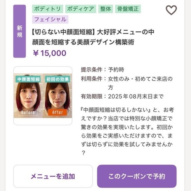 お顔の縦幅、改善できます◎