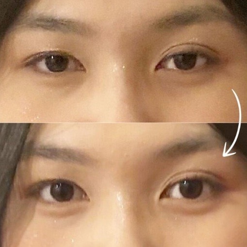 中顔面短縮！奥目解消！得意です☆